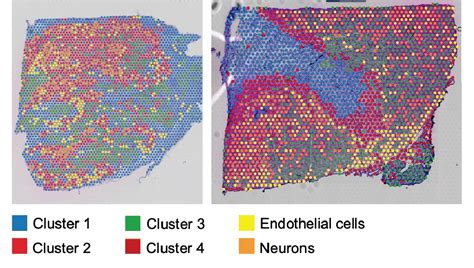 Single Cell And Spatial Sequencing Ultima Genomics Inc