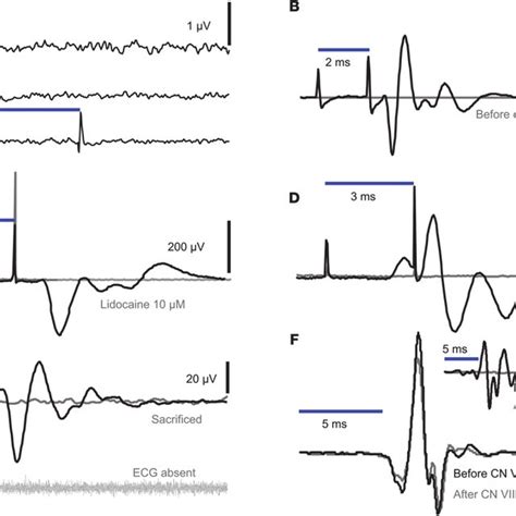 Cochlear optogenetics restores auditory activity in deaf mice. (A ...