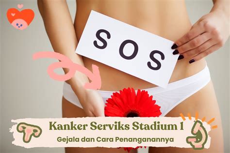 Kanker Serviks Stadium Gejala Dan Cara Penanganannya