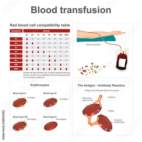 Types Of Transfusions