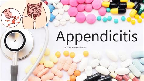 Appendicitis Causes Symptoms Treatment Options