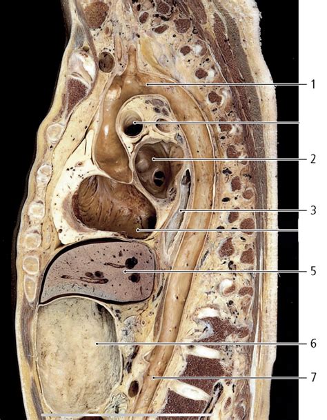 Pasi N Por La Anatom A On Twitter Corte Sagital Paraesternal A Trav S