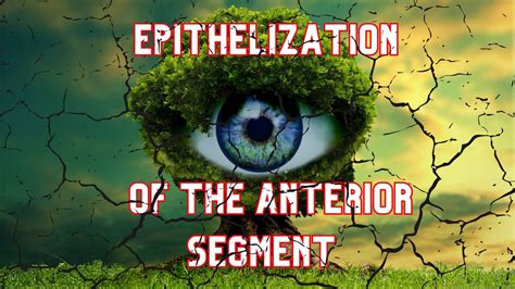 Epithelization Of The Anterior Segment Dr Anthony Maloof