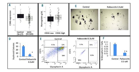 Reduced Expression Of CDK6 Is Seen In Human Myelodysplastic Syndrome