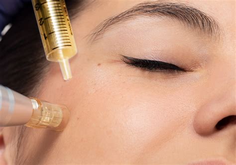 Microneedling Prp Services Infinity Dermatology