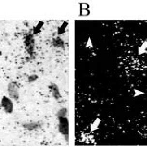 Bright Field A And Darkfield B Photomicrographs Of The Same