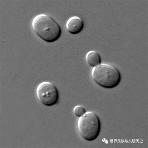 【地球生物全系列——从单细胞到人类】子囊菌门—酵母亚门腾讯新闻