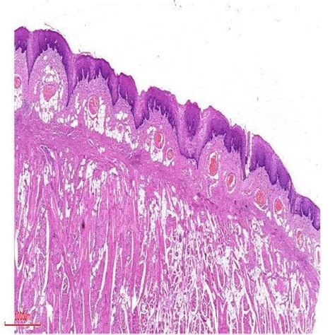 Foliate Papillae Histology