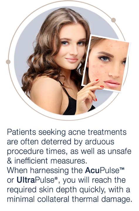 Acne Scars The Lumenis Solution AcuPulse UltraPulse Cosmetic