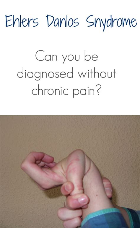 Ehlers Danlos Syndrome Without Pain?