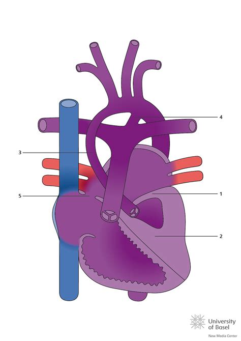 Hypoplastic Left Heart Syndrome HLHS Tiny Tickers