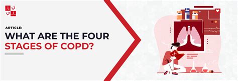 What Are The 4 Stages Of COPD CardiacDirect