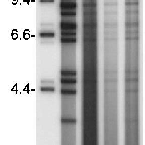 Bamhi Restriction Enzyme Analysis Of Genomes Of Portuguese Asf Virus