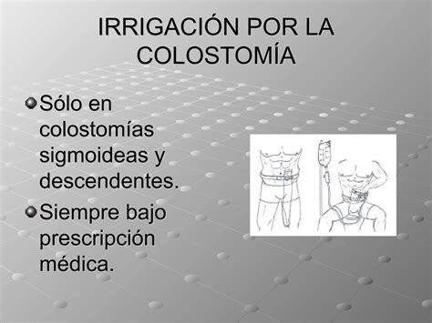 Todos Lo S Tipos De Ostomias Alimentacion Y Evacuantes Ppt