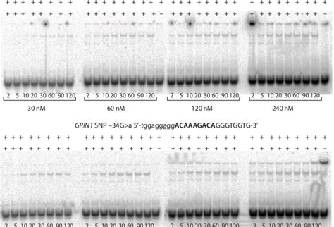 The Electropherograms Obtained To Determine Kinetic Isotherms Of Tbp