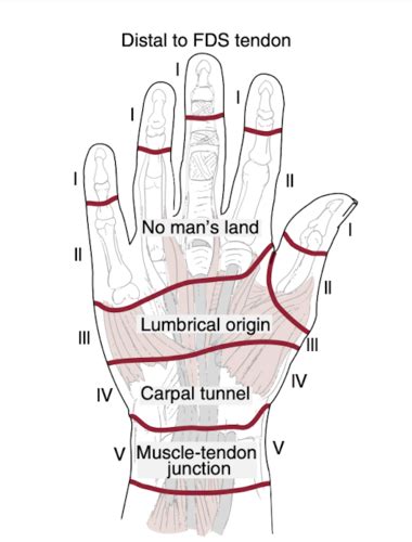 Pre Reading Orthopedic Pathologies Affecting The Hand And Wrist