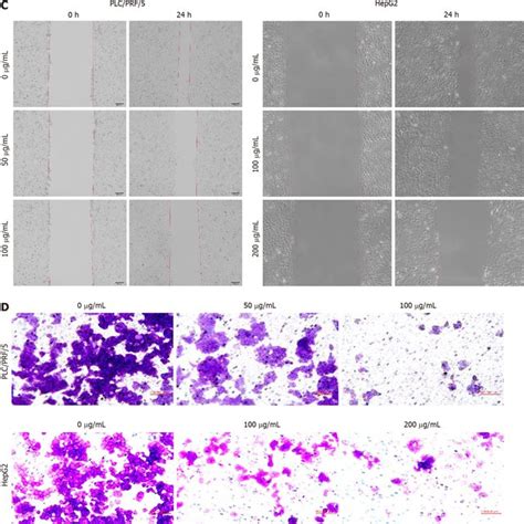 Huanglian Decoction Suppressed Hepatocellular Carcinoma Cell Growth In