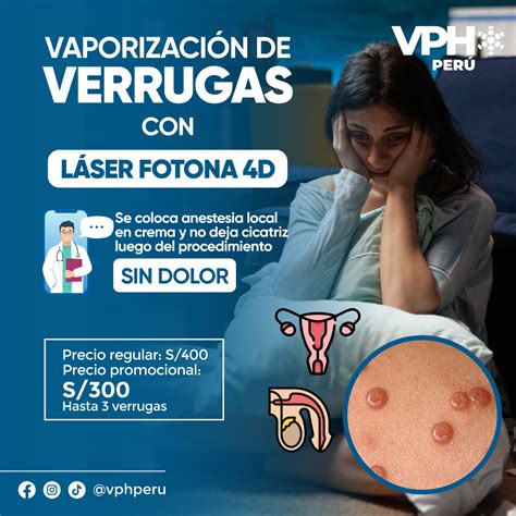 Eliminaci N De Verrugas Vph Peru