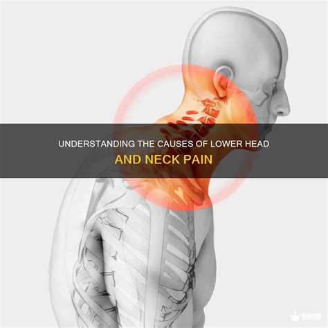 Understanding The Causes Of Lower Head And Neck Pain | MedShun