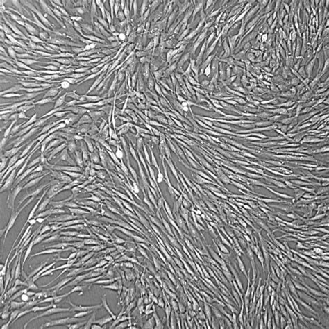 Primary Human Fibroblasts