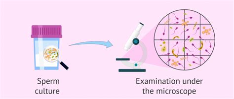 Leukocytes In The Sperm Analysis