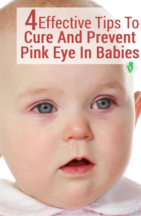 babies pink eye - pictures, photos