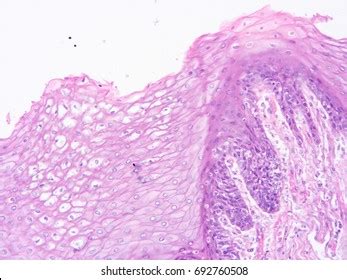 Histology Human Salivary Gland Tissue Show Stock Photo 692760508