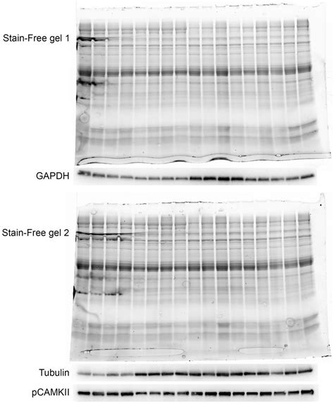 Figures And Data In Myopalladin Knockout Mice Develop Cardiac Dilation