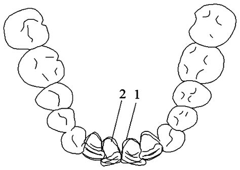 Shape Memory Material Based Oral Appliance Production Method And