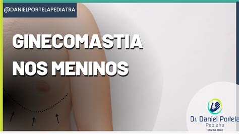 Ginecomastia nos meninos e a preocupação a imagem do adolescente