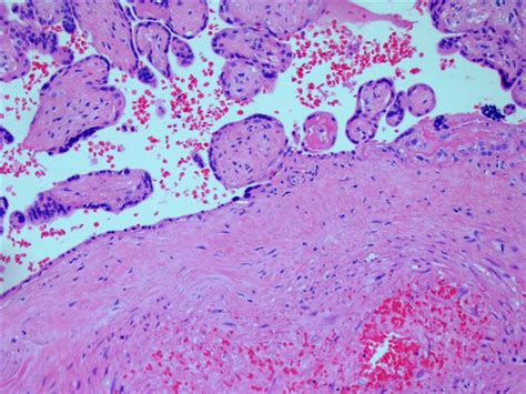 Pathology Outlines Case 193