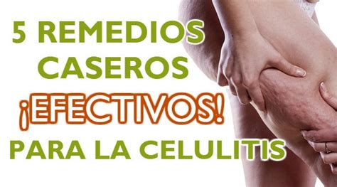 5 Remedios Caseros INFALIBLES Para Combatir La Celulitis