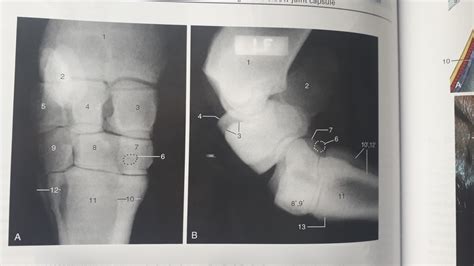 Radiographs of the carpus Diagram | Quizlet