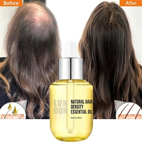 Fast Hair Growth For Men Women Ginger Grow Hair Oil Care Anti Hair Loss