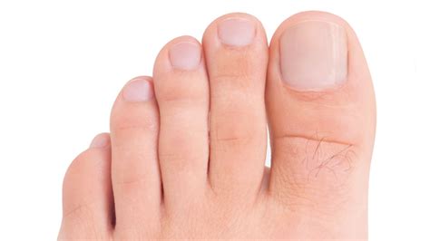 Sintetiza más de 60 imágenes sobre como cuidar las uñas de los pies