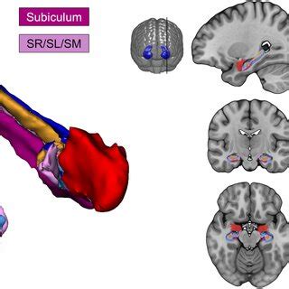 Visualization Of Hippocampal Subfield And Amygdala Segmentation Using