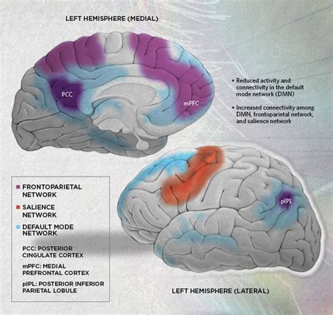 Infographic The Brain On Psychedelics The Scientist Magazine®