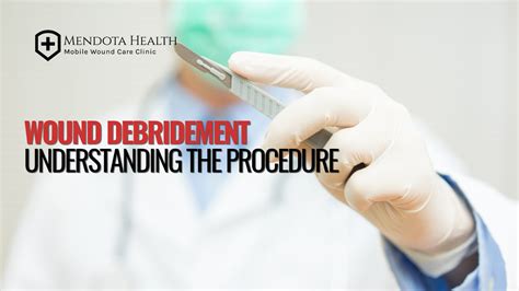 WOUND DEBRIDEMENT: UNDERSTANDING THE PROCEDURE - Mendota Health