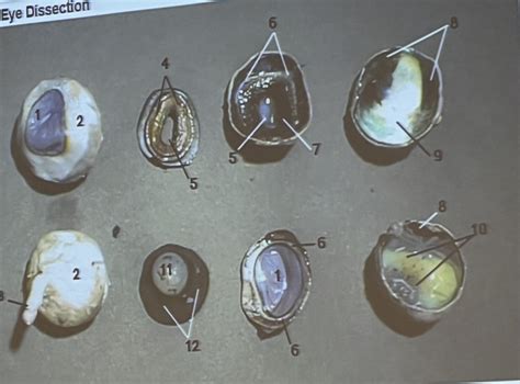 eye dissection Diagram | Quizlet