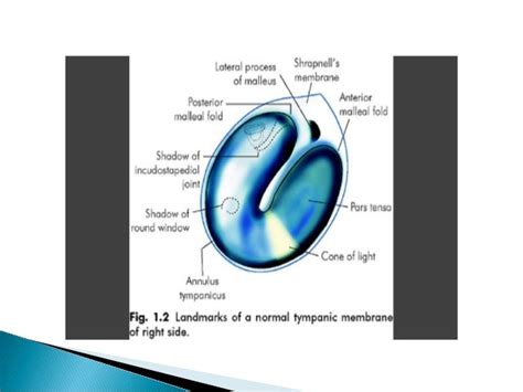 Anatomy of middle ear cleft microteaching, 06.03.17, dr.pk