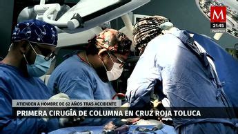 Cruz Roja Toluca realiza primera cirugía de columna en Edomex Grupo