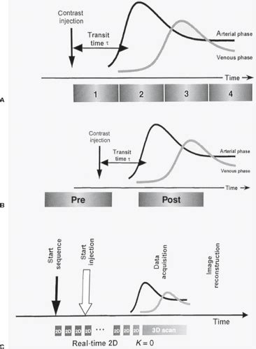 Mr Angiography Techniques And Clinical Applications Radiology Key