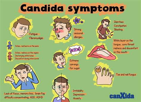 Signs & Symptoms of Candida | Candida symptoms, Candida, Candida infection