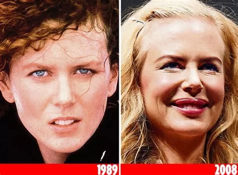 Which celebrities have had cosmetic surgery? - Mirror Online