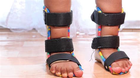 Andar na ponta dos pés e autismo qual é a relação