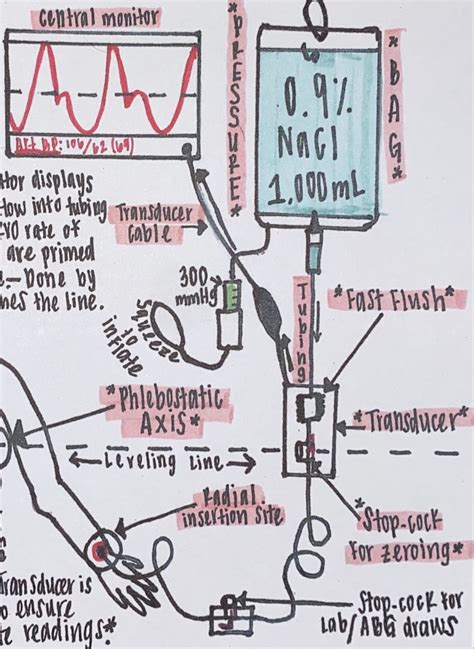 Arterial Line Icu Nurse Reference Sheet Etsy