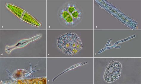 Protozoa Under Light Microscope