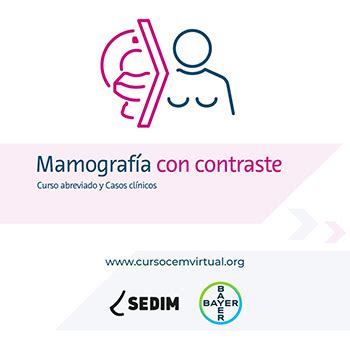 SEDIM Sociedad Española de Diagnóstico por Imagen de la Mama Sociedad