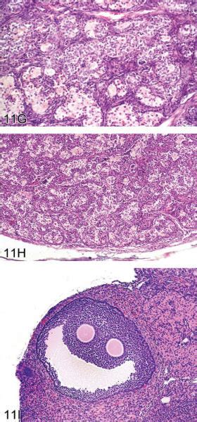 Ovarian Proliferative Lesions In Mice A Normal Ovary Showing Germ