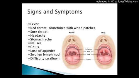 Streptococcus Group B